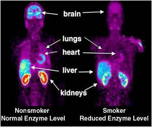 Pfizer's Anti-smoking Drug Chantix Linked With Heart Risks: Study Pfizer's Anti-smoking Drug Chantix Linked With Heart Risks: Study